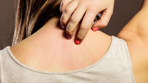 The Benefits Of Using Borage Oil For Hair And Skin