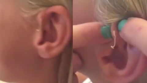 After 6 years, this girl finally got rid of the growth ruining her life