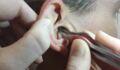 This Woman Couldn't Believe What She Found In Her Boyfriend's Ear