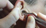 This Woman Couldn't Believe What She Found In Her Boyfriend's Ear