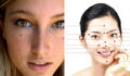 Here's what freckles on these 5 areas of your face say about your personality