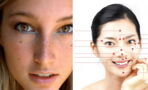 Here's what freckles on these 5 areas of your face say about your personality