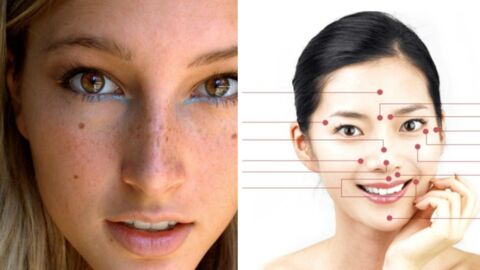Your Face Moles Reveal About Your Personality 