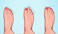 This Is What The Shape Of Your Feet Says About Your Personality