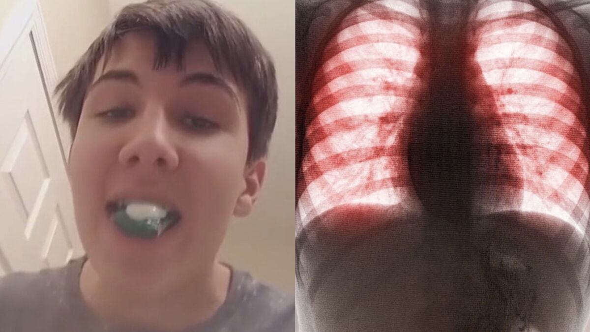 The Catastrophic Effects Of This Tide Pod Trend Can Kill You