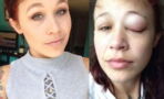 After getting an eye tattoo, things went from bad to worse for this lady