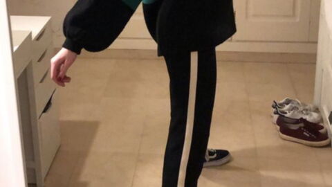 Optical illusion: How many legs do you see in this photo?