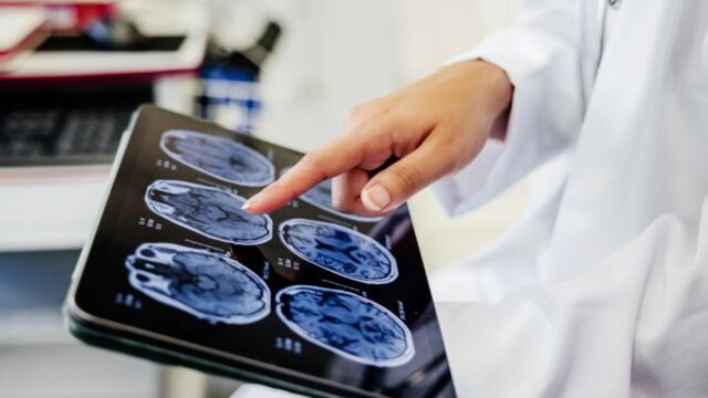 man runny nose six years brain poking out leaking health story