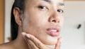 Understanding what triggers hormonal acne and how to treat it