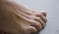 High cholesterol: Signs of the condition can be seen in your toenails