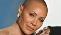 Alopecia: Which celebrities have the condition?