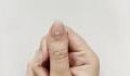 This is the surprising reason behind the white marks on your nails