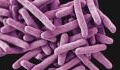 Tuberculosis and COVID: What are the common symptoms and differences?