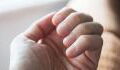 What does the colour of your nail say about your health?