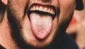 Hairy tongue: This man was diagnosed with this rare condition after his tongue turned green and hairy