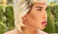 11 plastic surgeries later, the "Human Ken Doll's" nose has totally collapsed