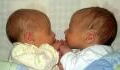 A Woman Recently Gave Birth To Twins Born In Different Years