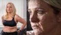 This body positive woman proudly bares her skin disease