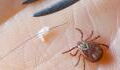 Tick-borne virus raising alarm in the UK: The initial symptoms you should know about