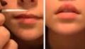 'Lip Glue Challenge' Could Have Some Dangerous Consequences