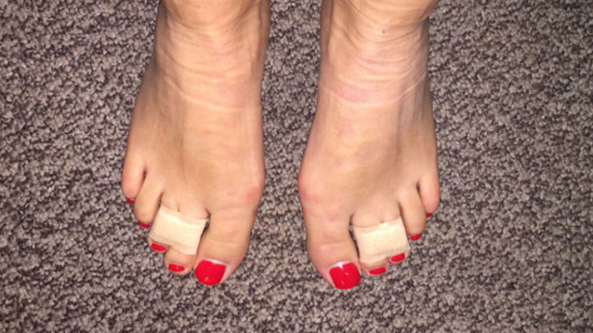 She Ties Her 3rd And 4th Toes Together For An Amazing Reason!