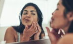 Here's how to properly pop your pimples without scarring