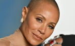 Alopecia: Which celebrities have the condition?