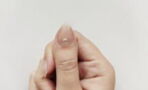 This is the surprising reason behind the white marks on your nails
