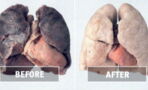 Want to clean your lungs from all that tar and nicotine buildup?