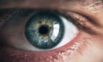 Myodesopsia: What are the jelly-like substances floating in your eyes?