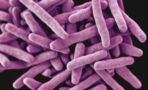 Tuberculosis and COVID: What are the common symptoms and differences?