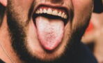 Hairy tongue: This man was diagnosed with this rare condition after his tongue turned green and hairy