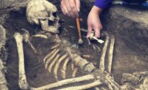 Ancient skeleton with amputated leg may well challenge the history of medicine