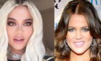 Khloe Kardashian's Face Looks Totally Different