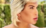 11 plastic surgeries later, the "Human Ken Doll's" nose has totally collapsed