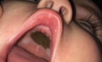 A brown spot in her baby's mouth made for a rather embarrassing hospital trip