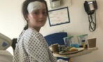 12-year-old girl left with severe burns after poached egg exploded in her face