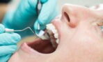 Study suggests that poor oral health could lead to brain decline