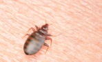 Trains, cinemas, hotels... These are all the places where you can find bed bugs, so watch out!