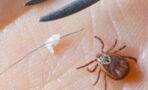 Tick-borne virus raising alarm in the UK: The initial symptoms you should know about