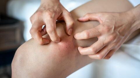 This man nearly lost his leg after being bitten by a spider