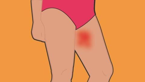 Here’s how to avoid chafed thighs this summer