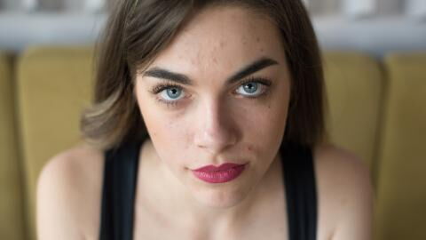 Could the cure to acne be to stop washing your face?