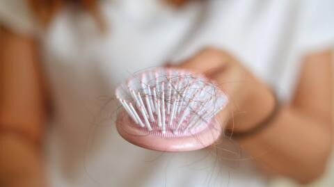 Losing more hair than normal? It may be because of lockdown