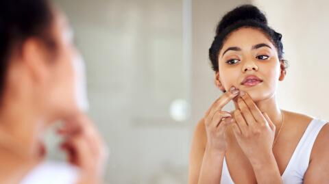 Ten common acne myths and why they aren’t true