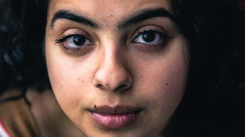 8 Amazing Home Remedies to get rid of Dark Spots