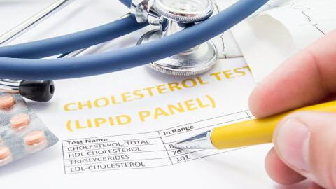 This is the first noticeable symptom of high cholesterol