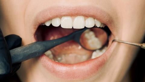 This nut may be a 'major contributor' to mouth cancer