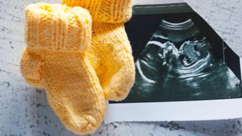 There's Another Love Island Baby On The Way