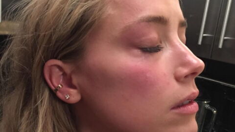 A friend claims Heard faked her bruises in order to blackmail Johnny Depp